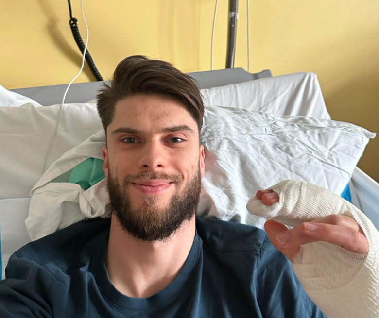 Volleyball superstar shows off his broken fingers, unknown date - Photo 1